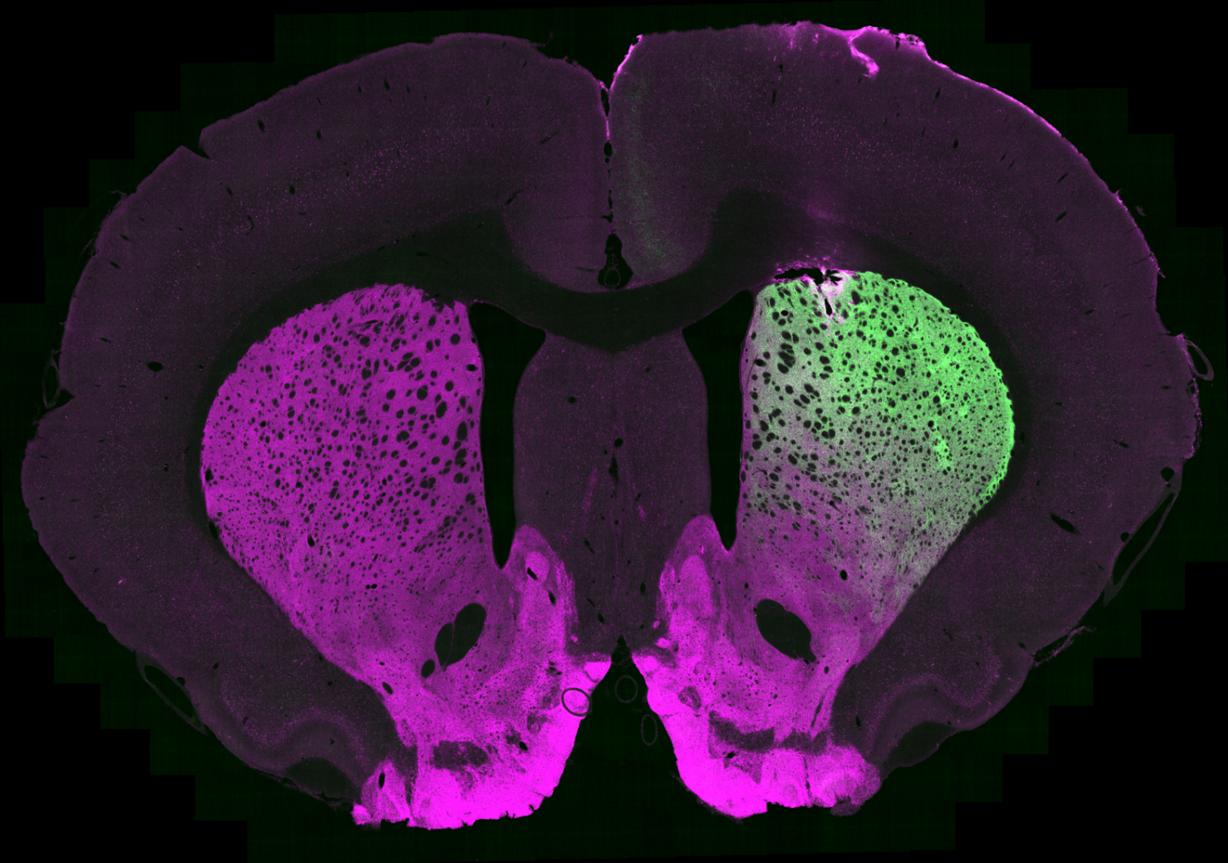 Fluorescence image of a coronal mouse brain section